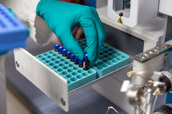 The analyses are carried out at the Labaqua laboratory, a pioneer in wastewater PCR.